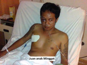 Juan_anak_Minggat beaten up